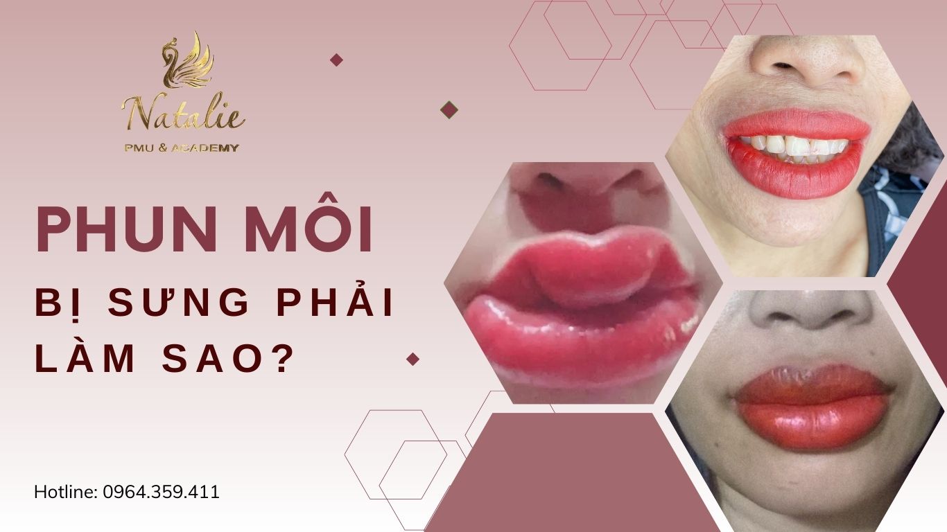 Phun Môi Bị Sưng Phải Làm Sao? 7 Nguyên Nhân Và Cách Xử Lý 